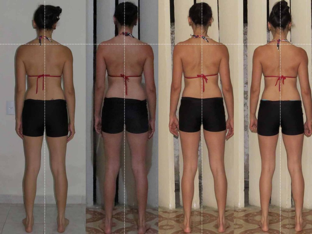 Foto-2--correção