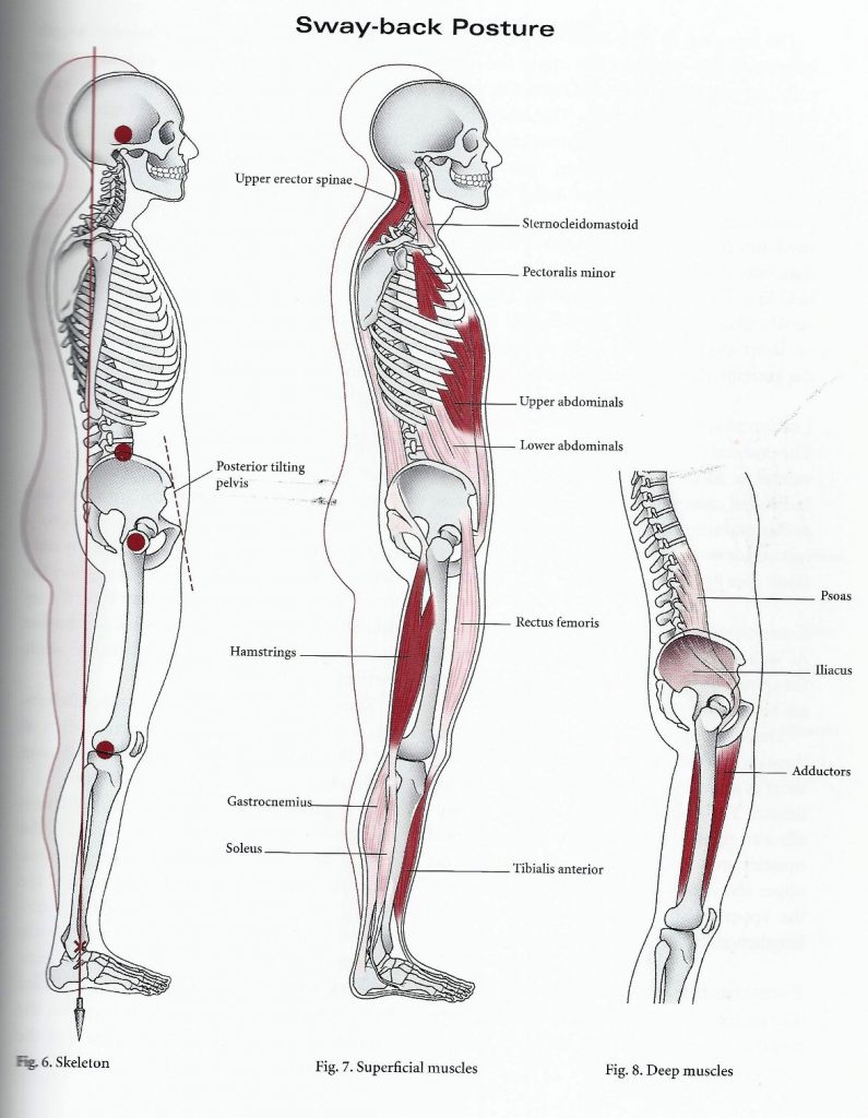 Swayback-musculos